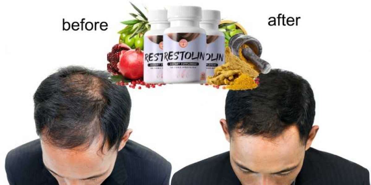 https://ipsnews.net/business/2021/05/21/restolin-review-2021-hair-regrowth-supplement-pros-cons-benefits-and-ingredients