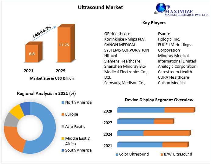 Ultrasound Market: Global Industry Analysis and Forecast (2022-2029)