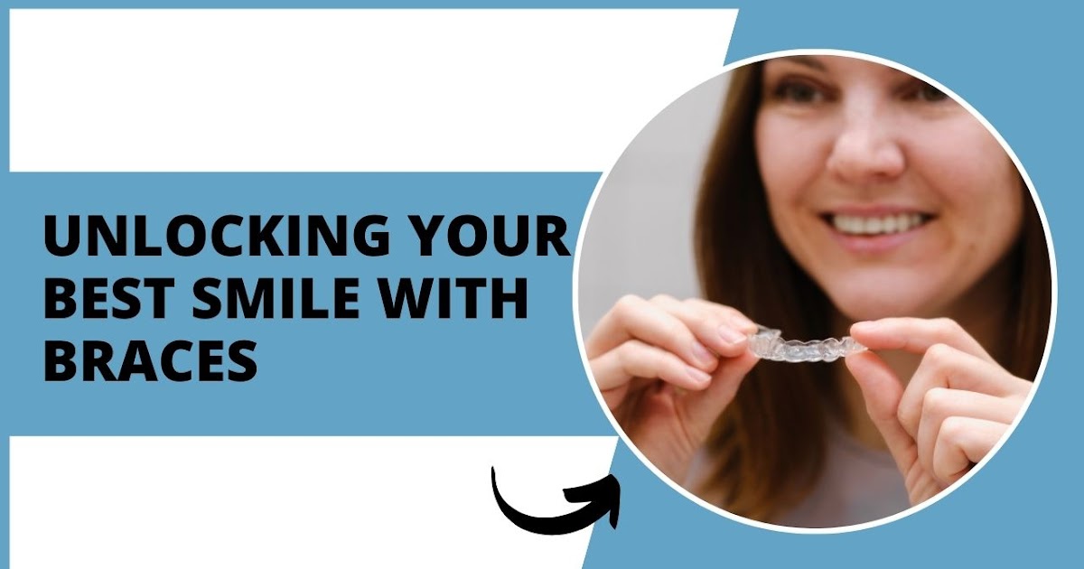Unlocking Your Best Smile with Braces