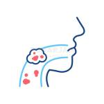 Prostate Cancer Profile Picture