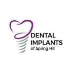 Dental Implants Spring Profile Picture