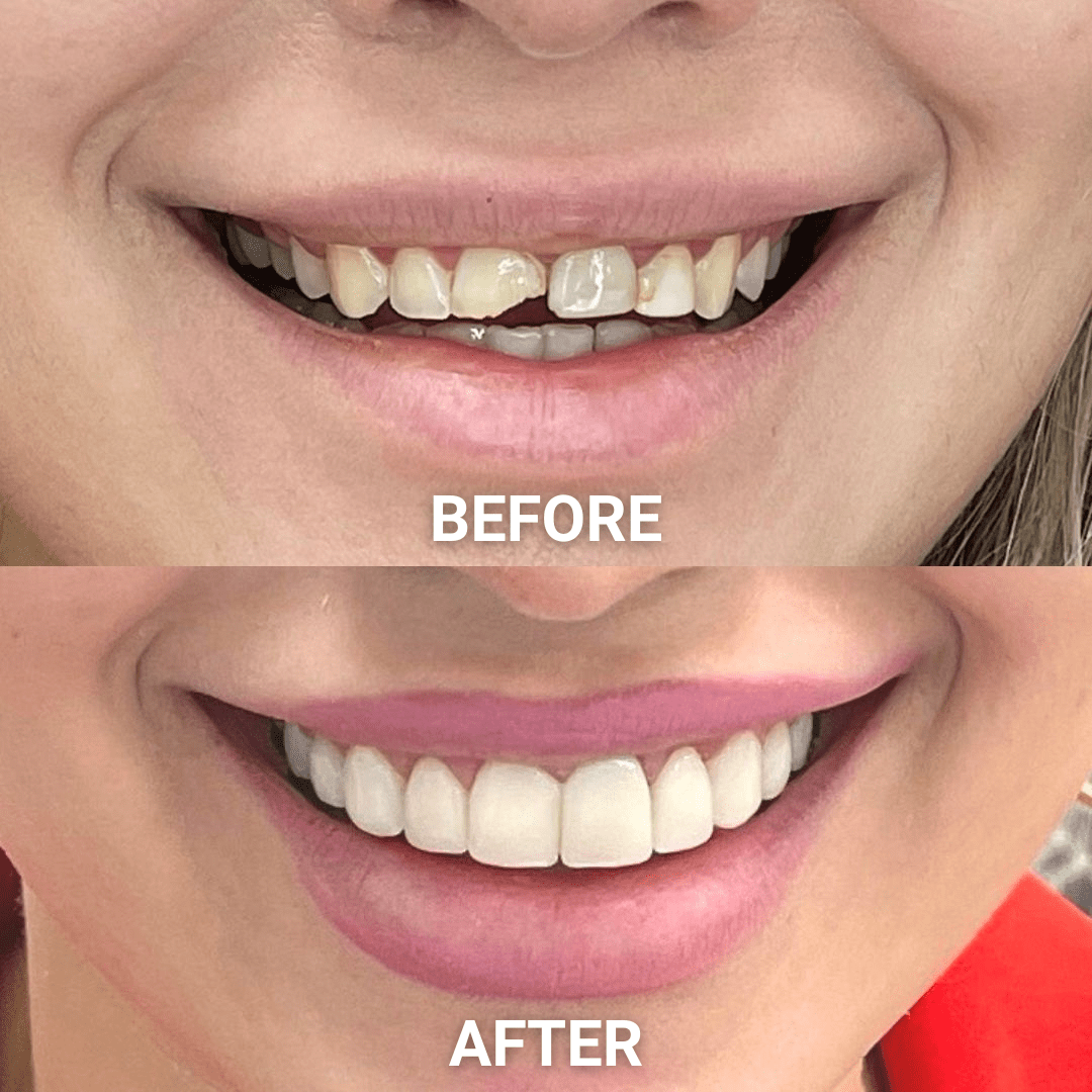 Leading Cosmetic Dentist in Adelaide, Dr Roshanak Amrein