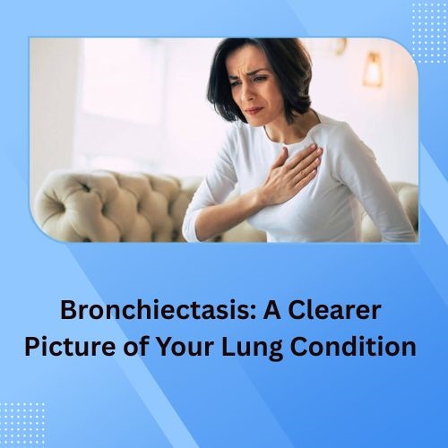 Bronchiectasis: A Clearer Picture of Your Lung Condition - Herbs Solutions By Nature Blog