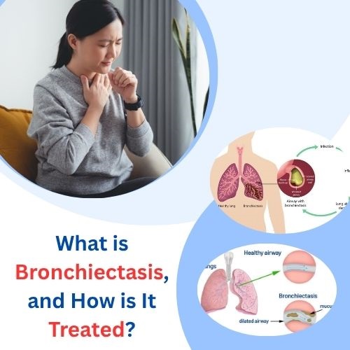 What is Bronchiectasis, and How is It Treated? - Herbs Solutions By Nature Blog
