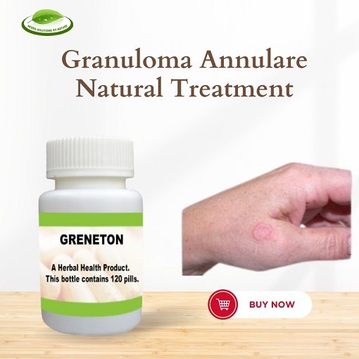 Granuloma Annulare Cancer: Everything You Need to Know