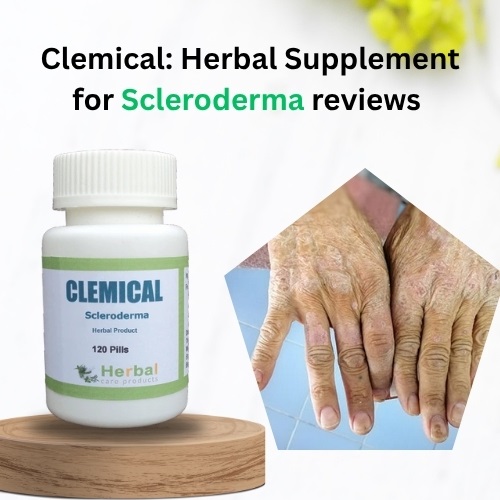 Clemical: Best Herbal Supplement for Scleroderma reviews - Herbal Care Products - Blog