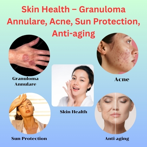 Skin Health – Granuloma Annulare, Acne, Sun Protection, Anti-aging - Natural Health News