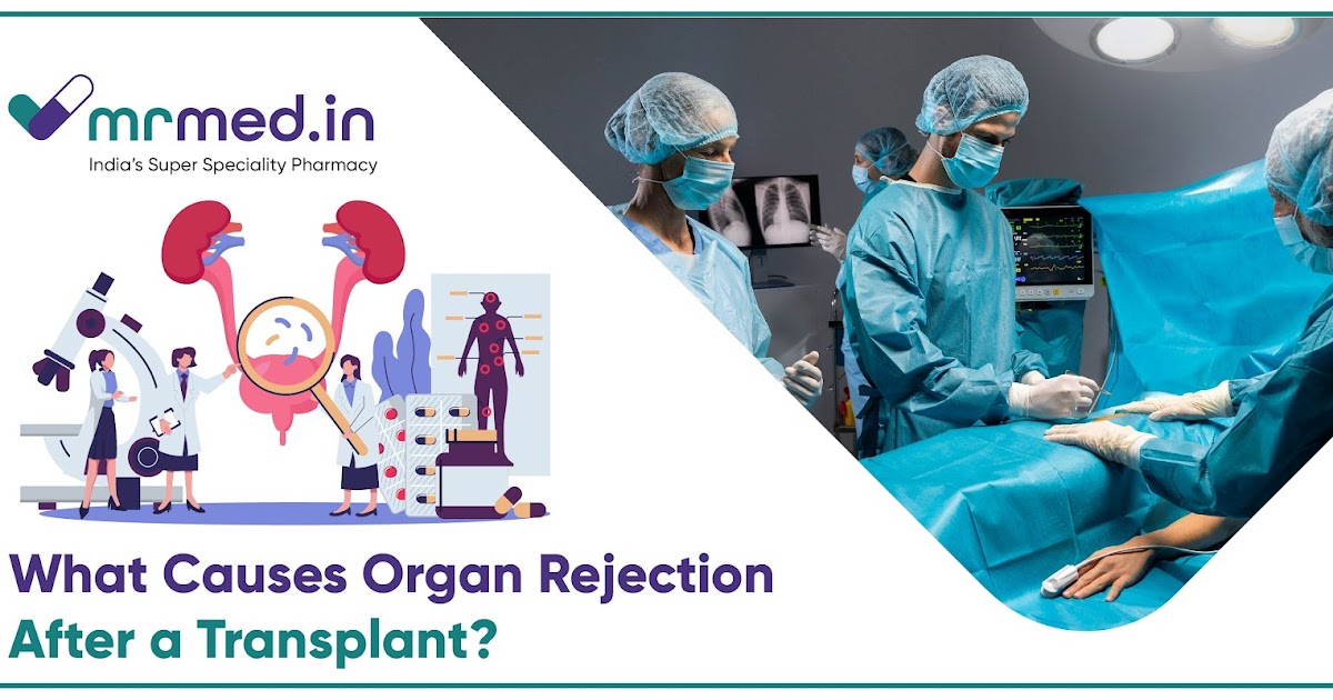 Top Reasons for Organ Rejection After Transplant & How to Overcome It