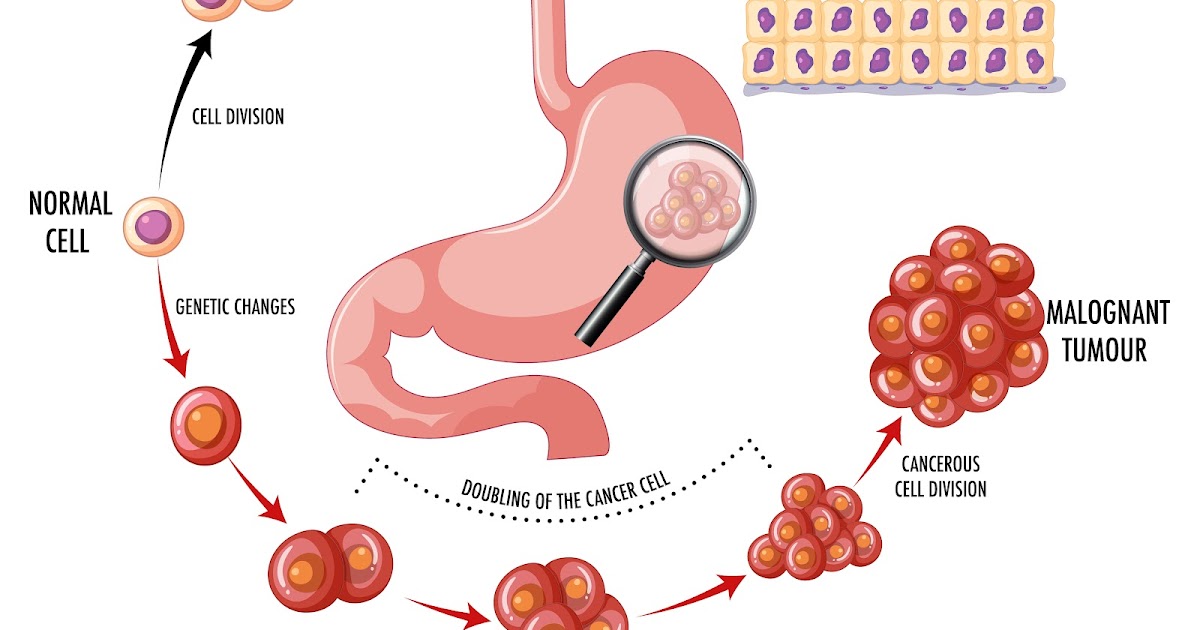 Esophageal Cancer Diagnosis: Tests and Procedures Explained
