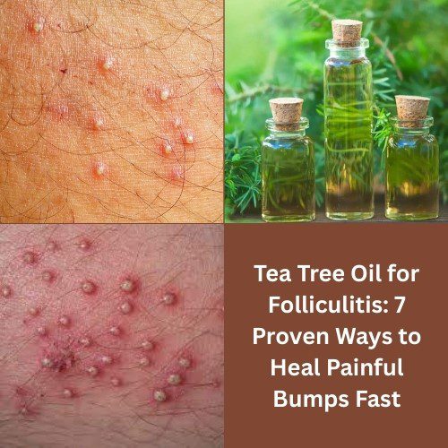 Tea Tree Oil for Folliculitis: 7 Proven Ways to Heal Painful Bumps Fast - Herbal Care Products - Blog