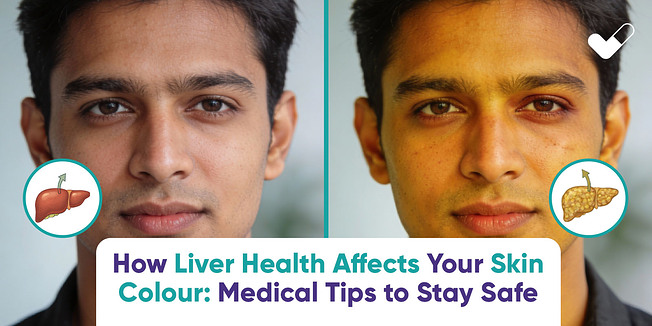 mrmedonlinepharmacy: How Liver Health Affects Your Skin Colour: Medical Tips to Stay Safe
