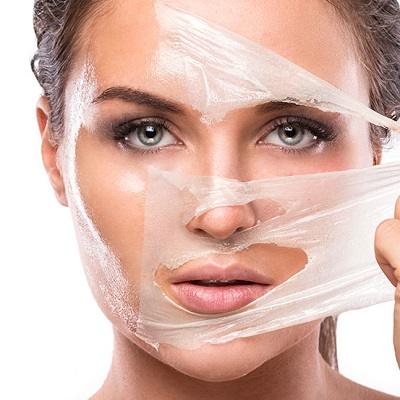 Best Chemical skin peel treatment in Islamabad - F7