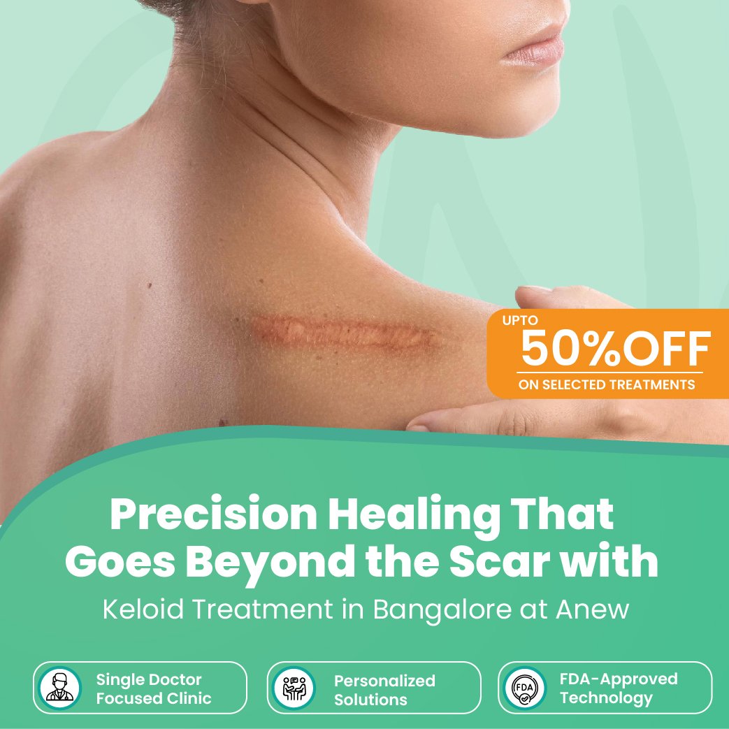 Keloid Treatment Near Me: Find the Right Care for Raised Scars