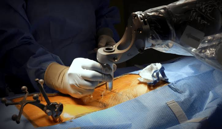 What Does a Lumbar Spine Surgeon Treat? A Guide for New Braunfels Patients – Bsiofsa