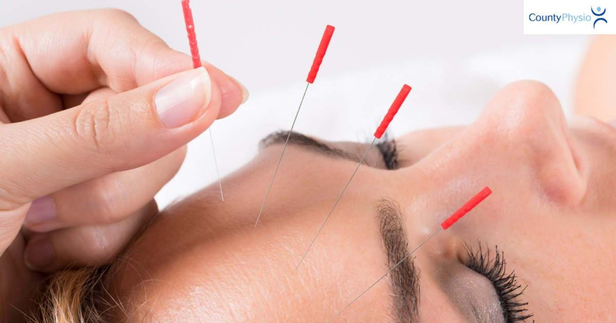 Could Acupuncture Be Right for You? A Guide for Tranent and East Linton
