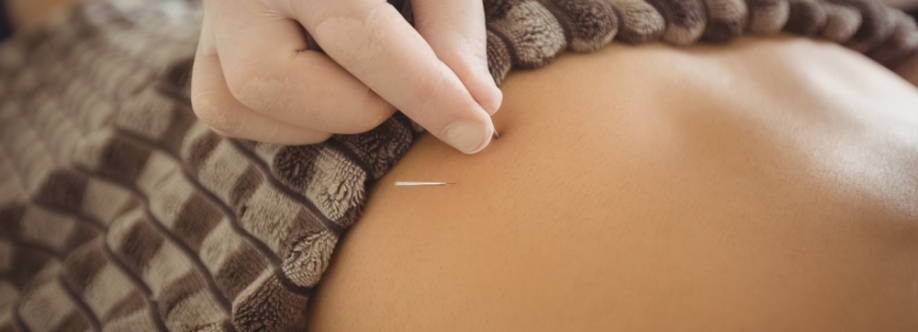 FCT Acupuncture Cover Image
